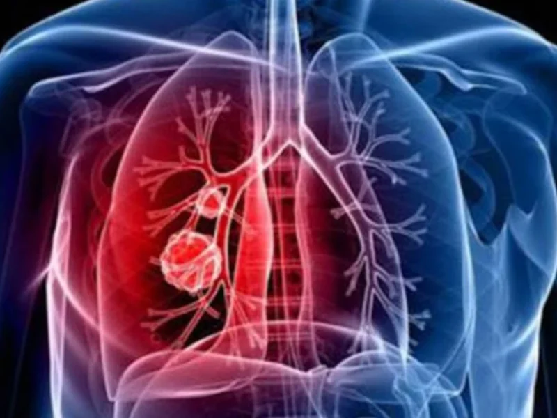 सिर्फ Lungs ही नहीं बल्कि लिवर-किडनी के लिए भी खतरनाक है Air Pollution